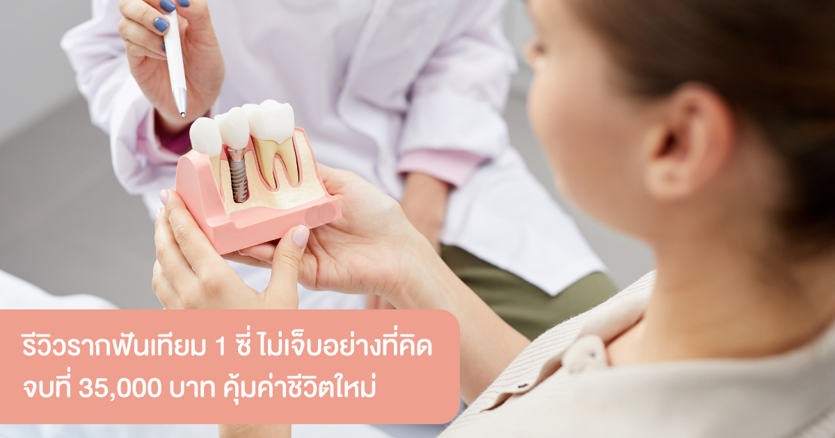 ประสบการณ์การรักษารากฟันเทียม (1)